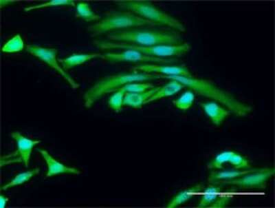 Immunocytochemistry/Immunofluorescence: AMPK alpha 2 Antibody [H00005563-D01P] - Analysis of antibody to PRKAA2 on HeLa cell. Antibody concentration 30 ug/ml.