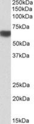 Western Blot: AMPK alpha 2 Antibody [NBP1-52073] - Western blot analysis of AMPK alpha 2 in Human Liver lysate (35ug protein in RIPA buffer) using NBP1-52073 at 1ug/ml. Primary incubation was 1 hour. Detected by chemiluminescence.