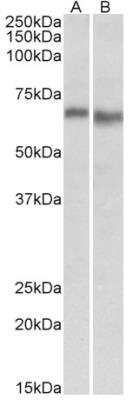 Western Blot: AMPK alpha 2 Antibody [NBP1-52073] - Staining of Mouse (A) and Rat (B) Heart lysate