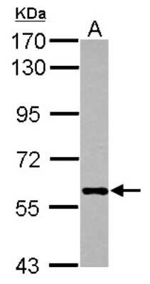 Western Blot: AMPK alpha 2 Antibody [NBP2-15381] - Sample (30 ug of whole cell lysate) A: HepG2 7. 5% SDS PAGE; antibody diluted at 1:1000.