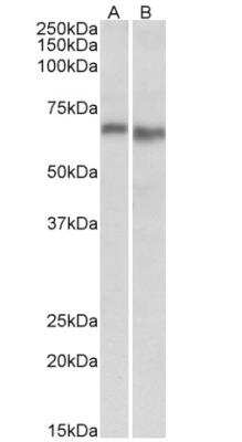 Western Blot: AMPK alpha 2 Antibody [NBP2-15381] - Staining of Mouse (A) and Rat (B) Heart lysate (35ug protein in RIPA buffer). Primary incubation was 1 hour. Detected by chemiluminescence.