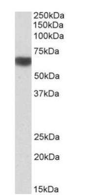 Western Blot: AMPK alpha 2 Antibody [NBP2-15381] - Staining of Human Liver lysate (35 ug protein in RIPA buffer). Primary incubation was 1 hour. Detected by chemiluminescence.