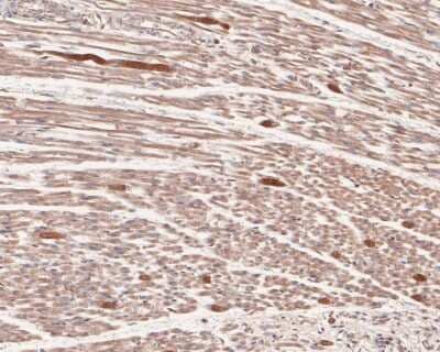 Immunohistochemistry-Paraffin: AMPK alpha 2 [p Ser345] Antibody (JJ08-19) [NBP2-67863] - Analysis of paraffin-embedded human fetal skeletal muscle tissue with Rabbit anti-AMPK alpha 2 [p Ser345] antibody washed with ddH2O and PBS, and then probed with the primary antibody at 1/50 dilution for 1 hour at room temperature. The detection was performed using an HRP conjugated compact polymer system. DAB was used as the chromogen. Tissues were counterstained with hematoxylin and mounted with DPX.