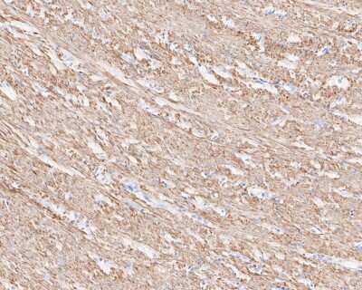 Immunohistochemistry-Paraffin: AMPK beta 1 Antibody (SD082-06) [NBP2-67787] - Immunohistochemical analysis of paraffin-embedded human smooth muscle tissue using anti-AMPK beta 1 antibody. The section was pre-treated using heat mediated antigen retrieval with sodium citrate buffer (pH 6.0) for 20 minutes. The tissues were blocked in 5% BSA for 30 minutes at room temperature, washed with ddH2O and PBS, and then probed with the primary antibody (1/200) for 30 minutes at room temperature. The detection was performed using an HRP conjugated compact polymer system. DAB was used as the chromogen. Tissues were counterstained with hematoxylin and mounted with DPX.