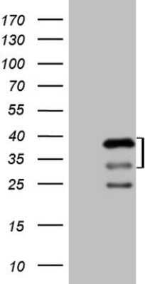 Western Blot: AMPK beta 2/PRKAB2 Antibody (OTI4H4) - Azide and BSA Free [NBP2-71226] - Analysis of HEK293T cells were transfected with the pCMV6-ENTRY control (Left lane) or pCMV6-ENTRY PRKAB2.