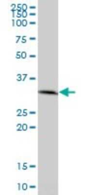 Western Blot: AMPK beta 2/PRKAB2 Antibody [H00005565-B01P] - Analysis of PRKAB2 expression in human liver.