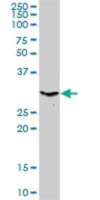 Western Blot: AMPK beta 2/PRKAB2 Antibody [H00005565-D01P] - Analysis of PRKAB2 expression in mouse kidney.
