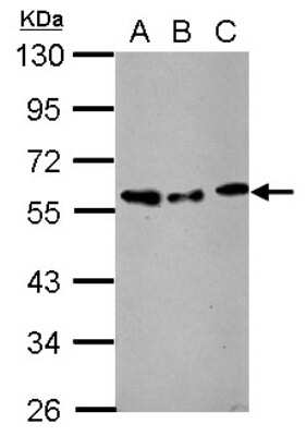 Western Blot: AMSH/STAMBP Antibody [NBP2-15383] -  Sample (30 ug of whole cell lysate) A: NIH-3T3 B: JC C: BCL-1 10% SDS PAGE; antibody diluted at 1:1000.