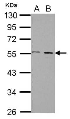 Western Blot AMSH/STAMBP Antibody