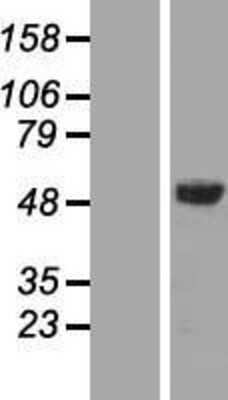 Western Blot AMSH/STAMBP Overexpression Lysate