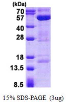 SDS-Page: Recombinant Human AMSH/STAMBP Protein [NBP2-22825]