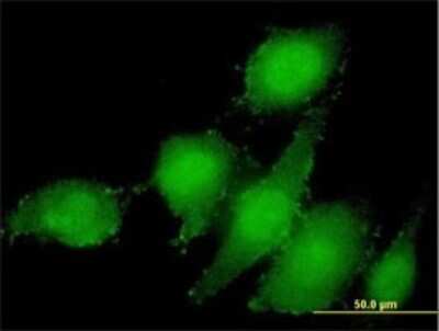 Immunocytochemistry/Immunofluorescence: AMSH/STAMBP Antibody (1A8) [H00010617-M01] - Analysis of monoclonal antibody to STAMBP on HeLa cell . Antibody concentration 10 ug/ml.