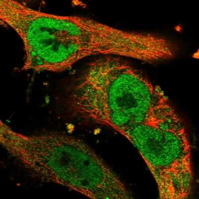 Immunocytochemistry/Immunofluorescence: AMSH/STAMBP Antibody [NBP1-90172] - Staining of human cell line U-251 MG shows localization to nucleoplasm & cytosol. Antibody staining is shown in green.