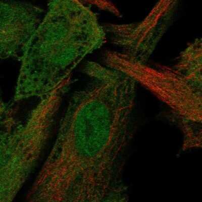 Immunocytochemistry/Immunofluorescence: AMSH/STAMBP Antibody [NBP2-68627] - Staining of human cell line LHCN-M2 shows localization to nucleoplasm, plasma membrane & cytosol.