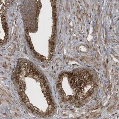 Immunohistochemistry-Paraffin: AMSH/STAMBP Antibody [NBP1-90172] - Staining of human prostate shows strong cytoplasmic positivity in glandular cells.