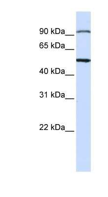 Western Blot: AMSH/STAMBP Antibody [NBP1-58334] - Titration: 0.2-1 ug/ml, Positive Control: Jurkat cell lysate.