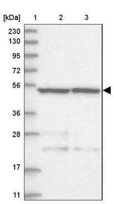 Western Blot AMSH/STAMBP Antibody