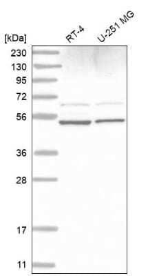 Western Blot: AMSH/STAMBP Antibody [NBP2-68627] - Analysis in human cell line RT-4 and human cell line U-251 MG.