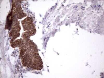 Immunohistochemistry: AMTN Antibody (2D9) [NBP2-46517] - Analysis of Human prostate tissue. (Heat-induced epitope retrieval by 1mM EDTA in 10mM Tris buffer (pH8.5) at 120C for 3 min)