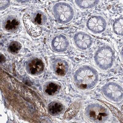 Immunohistochemistry-Paraffin: AMTN Antibody [NBP2-32718] - Staining of human small intestine shows strong cytoplasmic positivity in glandular cells with distinct extracellular material.