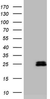 Western Blot: AMTN Antibody (OTI2D9) - Azide and BSA Free [NBP2-72507] - Analysis of HEK293T cells were transfected with the pCMV6-ENTRY control (Left lane) or pCMV6-ENTRY AMTN.