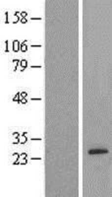 Western Blot: AMTN Overexpression Lysate (Adult Normal) [NBP2-04474] Left-Empty vector transfected control cell lysate (HEK293 cell lysate); Right -Over-expression Lysate for AMTN.