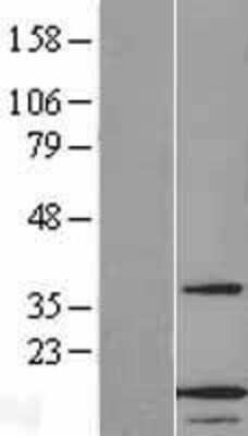 Western Blot: ANAPC13 Overexpression Lysate (Adult Normal) [NBL1-07515] Left-Empty vector transfected control cell lysate (HEK293 cell lysate); Right -Over-expression Lysate for ANAPC13.