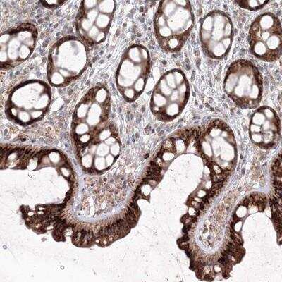 Immunohistochemistry-Paraffin: ANAPC16 Antibody [NBP1-89048] - Staining of human colon shows strong cytoplasmic positivity in glandular cells.