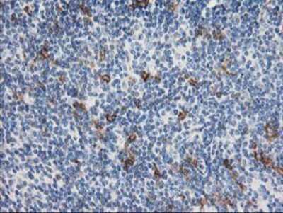 Immunohistochemistry-Paraffin: ANAPC2 Antibody (1A6) [NBP2-01128] - Staining of paraffin-embedded Human lymphoma tissue using anti-ANAPC2 mouse monoclonal antibody.