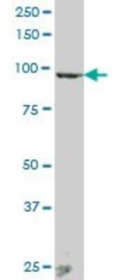 Western Blot ANAPC2 Antibody