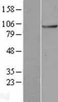 Western Blot ANAPC2 Overexpression Lysate