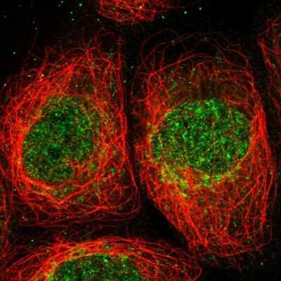 Immunocytochemistry/Immunofluorescence: ANGEL2 Antibody [NBP1-83712] - Immunofluorescent staining of human cell line A-431 shows localization to nucleoplasm & mitochondria.