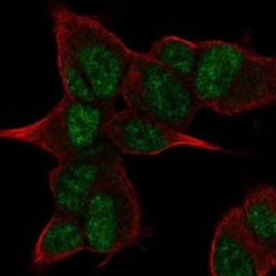 Immunocytochemistry/Immunofluorescence: ANGEL2 Antibody [NBP3-17339] - Staining of human cell line SH-SY5Y shows localization to nucleoplasm.