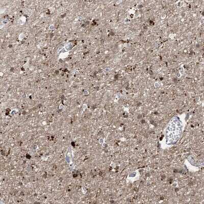 Immunohistochemistry-Paraffin: ANGEL2 Antibody [NBP1-83712] - Staining of human cerebral cortex shows strong cytoplasmic granular positivity in neurons.