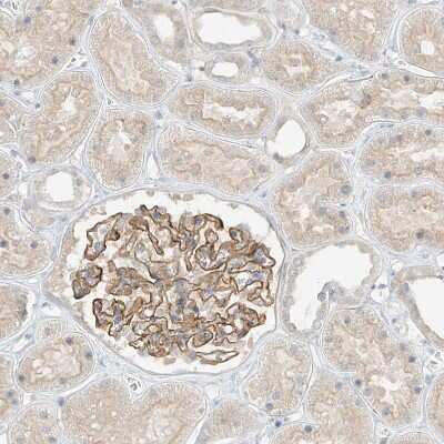 Immunohistochemistry-Paraffin: ANGEL2 Antibody [NBP1-83712] - Staining of human kidney shows strong membranous positivity in cells in glomeruli.