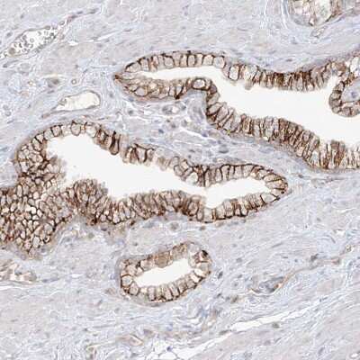Immunohistochemistry-Paraffin: ANGEL2 Antibody [NBP1-83712] - Staining of human prostate shows strong membranous positivity in glandular cells.