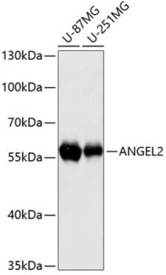 Western Blot: ANGEL2 Antibody [NBP2-92088] - Analysis of extracts of various cell lines, using ANGEL2 .Exposure time: 90s.