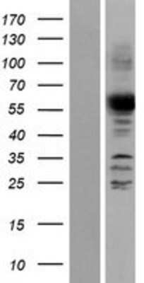 Western Blot: ANGEL2 Overexpression Lysate (Adult Normal) [NBP2-05558] Left-Empty vector transfected control cell lysate (HEK293 cell lysate); Right -Over-expression Lysate for ANGEL2.