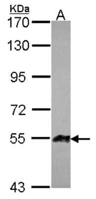 Western Blot: Angiopoietin-like Protein 1/ANGPTL1 Antibody [NBP2-15389] -  Sample (30 ug of whole cell lysate) A: JurKat 7.5% SDS PAGE; antibody diluted at 1:1000.