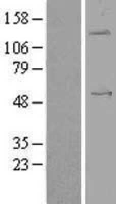 Western Blot Angiopoietin-like Protein 1/ANGPTL1 Overexpression Lysate