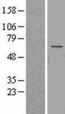 Western Blot Angiopoietin-like Protein 3/ANGPTL3 Overexpression Lysate
