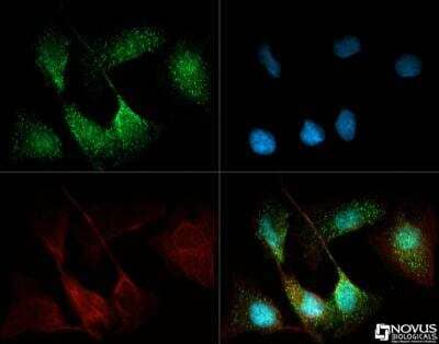 Immunocytochemistry/Immunofluorescence: Angiopoietin-like Protein 4/ANGPTL4 Antibody [NBP2-19016] - Antibody was tested in U2OS cells with Dylight 488 (green). Nuclei and alpha-tubulin were counterstained with DAPI (blue) and Dylight 550 (red).