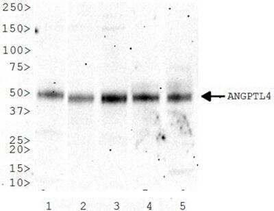 Western Blot: Angiopoietin-like Protein 4/ANGPTL4 Antibody [NBP2-19016] - Analysis of ANGPTL4 in 1) Human pancreas 2) Human lung 3) Human lymph node 4) Human adipose and 5) Human breast cancer lysate.