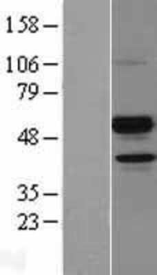 Western Blot: Angiopoietin-like Protein 7/ANGPTL7 Overexpression Lysate [NBL1-07529] -  Left-Empty vector transfected control cell lysate (HEK293 cell lysate); Right -Over-expression Lysate for ANGPTL7.