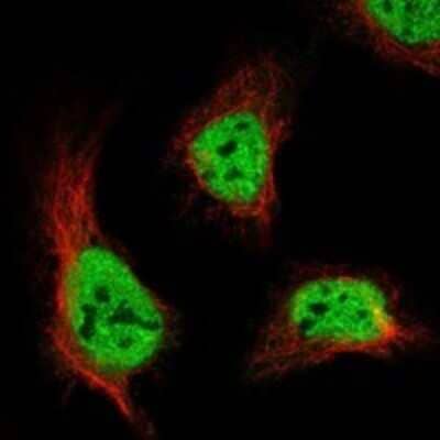 Immunocytochemistry/Immunofluorescence: ANKFN1 Antibody [NBP3-17466] - Staining of human cell line U-2 OS shows localization to nucleoplasm.