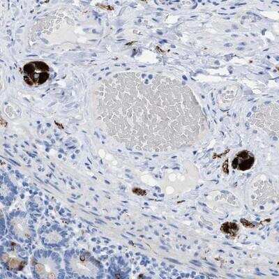 Immunohistochemistry-Paraffin: ANKFN1 Antibody [NBP1-93804] - Staining of human duodenum shows strong cytoplasmic positivity in peripheral nerves.