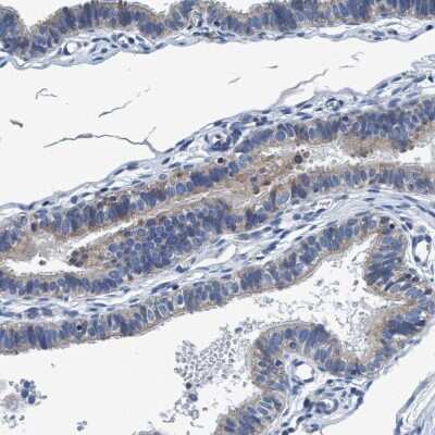 Immunohistochemistry-Paraffin ANKFN1 Antibody