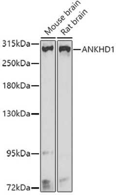 Western Blot: ANKHD1 Antibody [NBP2-92533] - Analysis of extracts of various cell lines, using ANKHD1 at 1:1000 dilution.Secondary antibody: HRP Goat Anti-Rabbit IgG (H+L) at 1:10000 dilution.Lysates/proteins: 25ug per lane.Blocking buffer: 3% nonfat dry milk in TBST.Detection: ECL Basic Kit .Exposure time: 30s.