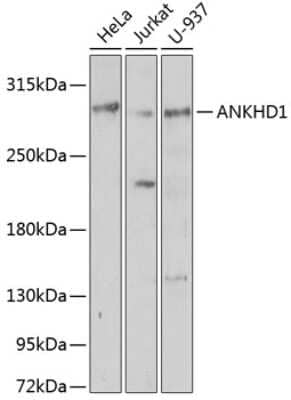 Western Blot: ANKHD1 Antibody [NBP2-92751] - Analysis of extracts of various cell lines, using ANKHD1 at 1:1000 dilution.Secondary antibody: HRP Goat Anti-Rabbit IgG (H+L) at 1:10000 dilution.Lysates/proteins: 25ug per lane.Blocking buffer: 3% nonfat dry milk in TBST.Detection: ECL Basic Kit .Exposure time: 30s.