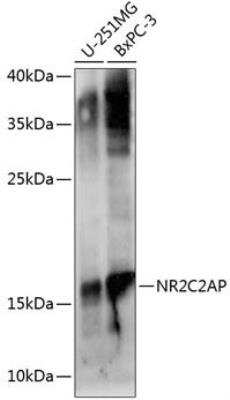 Western Blot: ANKHD1 Antibody [NBP2-92751] - Analysis of extracts of various cell lines, using NR2C2AP antibody at 1:1000 dilution.Secondary antibody: HRP Goat Anti-Rabbit IgG (H+L) at 1:10000 dilution.Lysates/proteins: 25ug per lane. Blocking buffer: 3% nonfat dry milk in TBST.Detection: ECL Basic Kit. Exposure time: 90s.